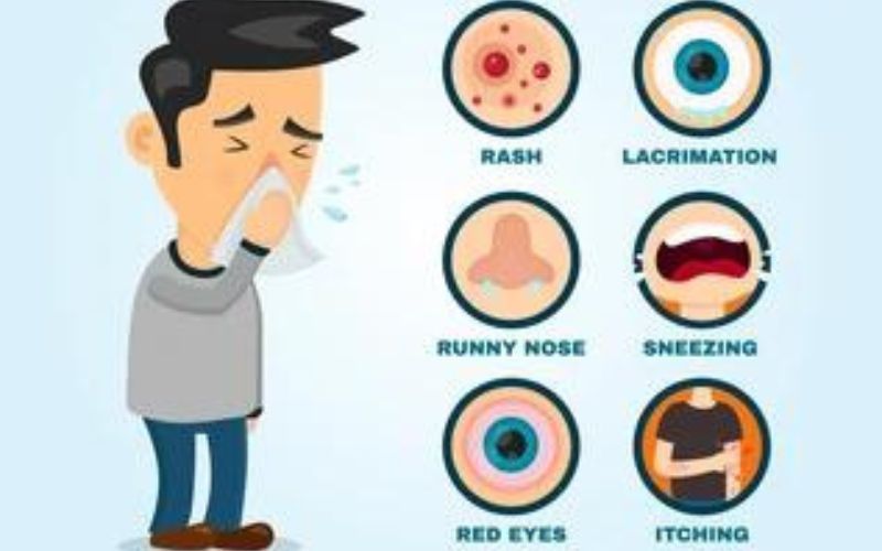 Symptoms of Allergy