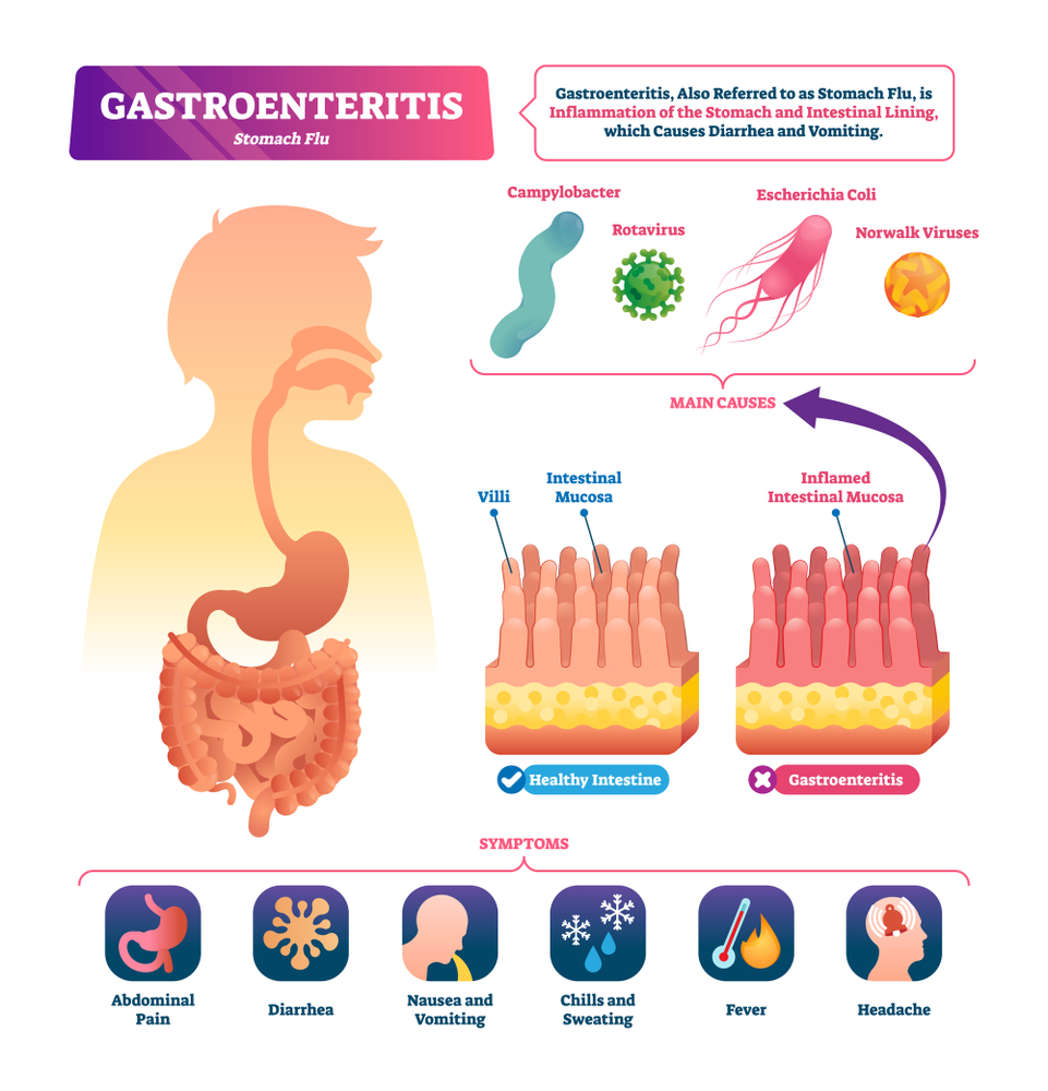 Gastroenteritis