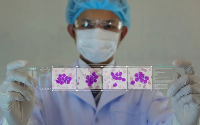 Leukemia Hives: What To Know About Causes, And Treatment