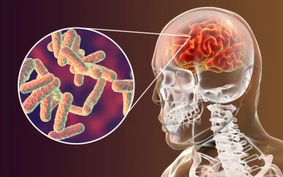 Discover How Meningitis Spreads and Protect Yourself