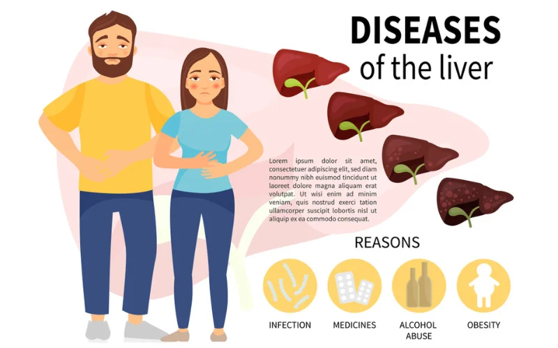 cholestasis liver disease