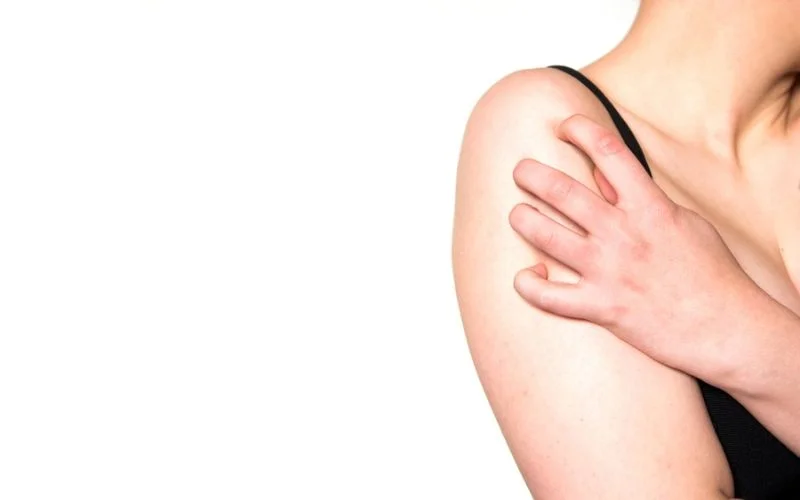 Urticaria