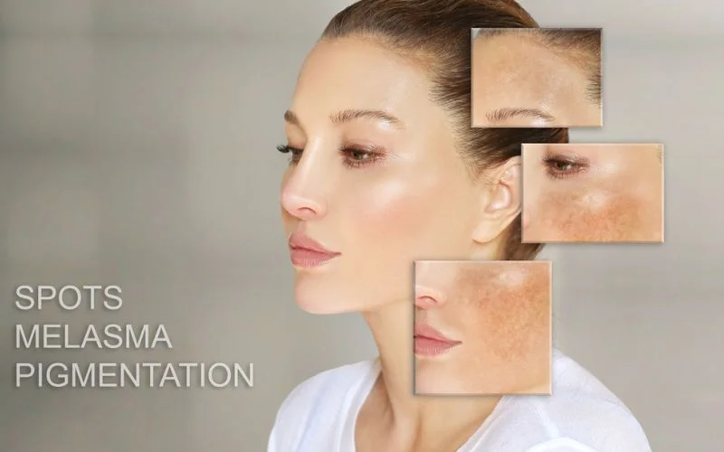Skin Irritations